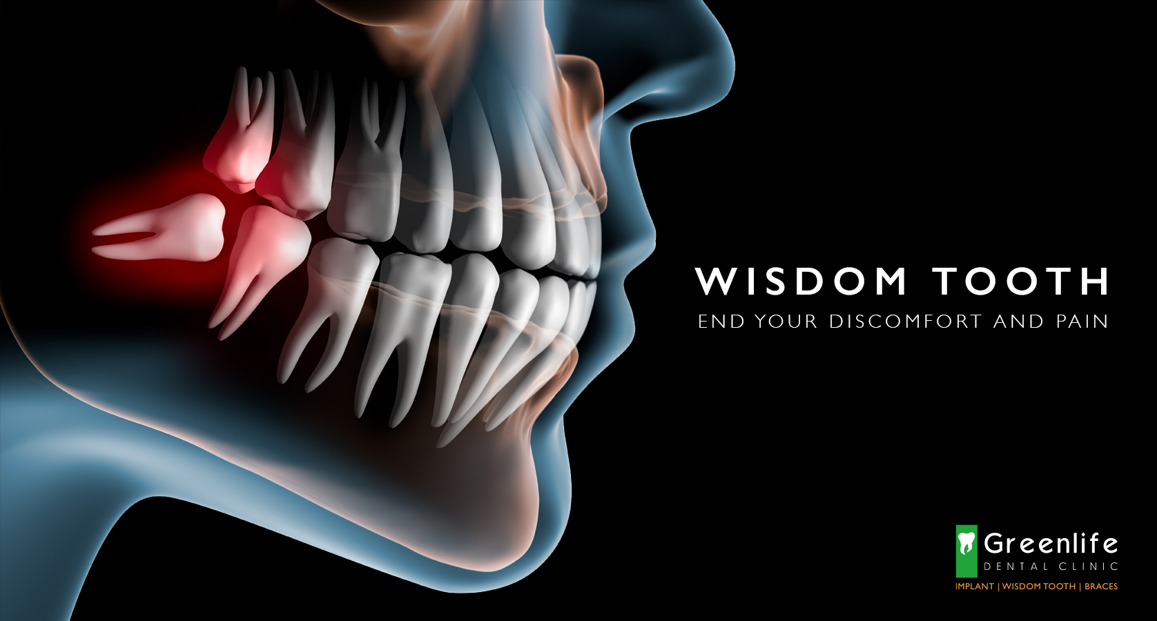 Wisdom Tooth our strength