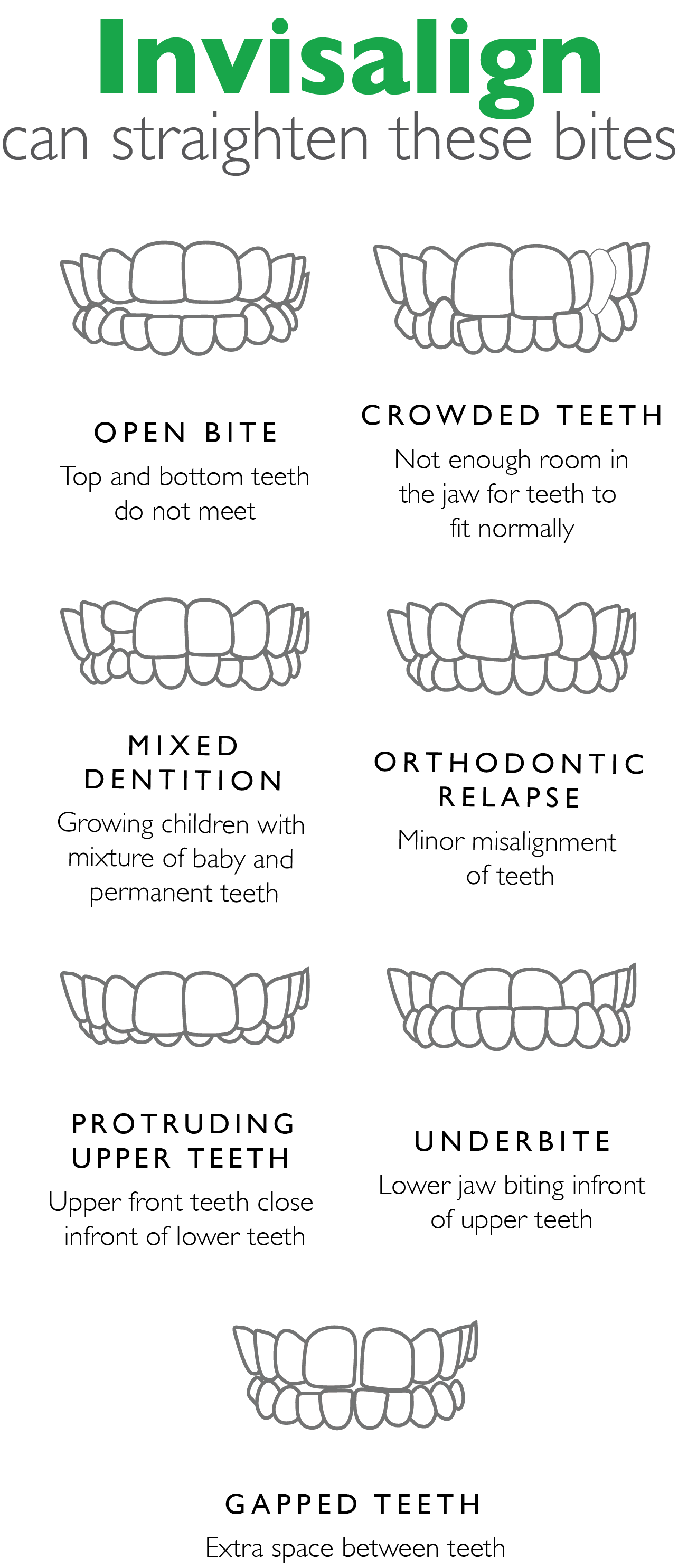 Invisalign Bites braces or invisalign